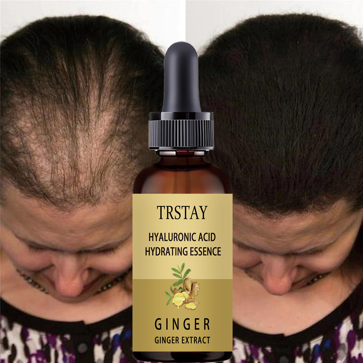 Soro de crescimento capilar an - Caffeine Hair Serum avaliação e preço