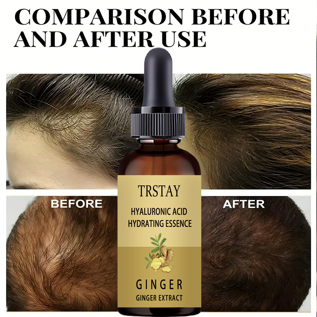 Soro de crescimento capilar an - Caffeine Hair Serum avaliação e preço