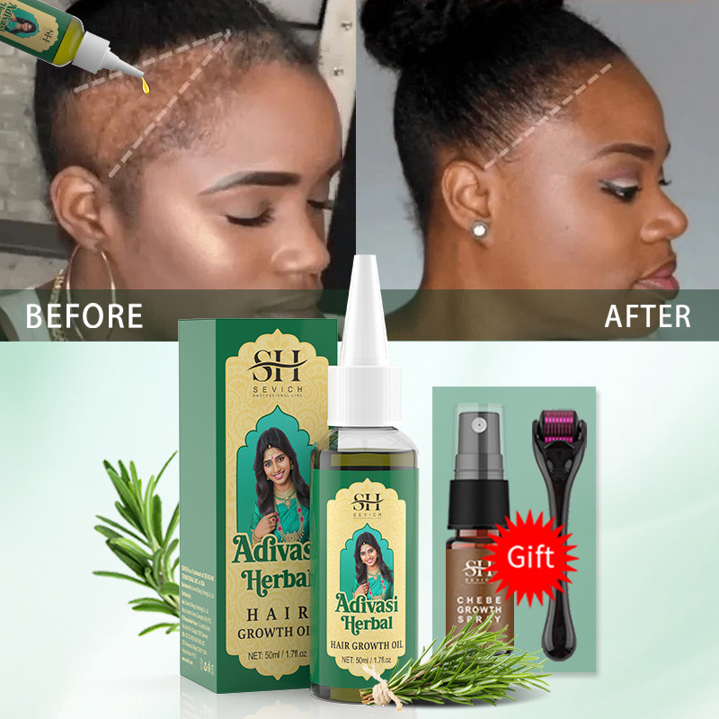 Óleo Ayurvédico para Crescimen - Caffeine Hair Serum avaliação e preço