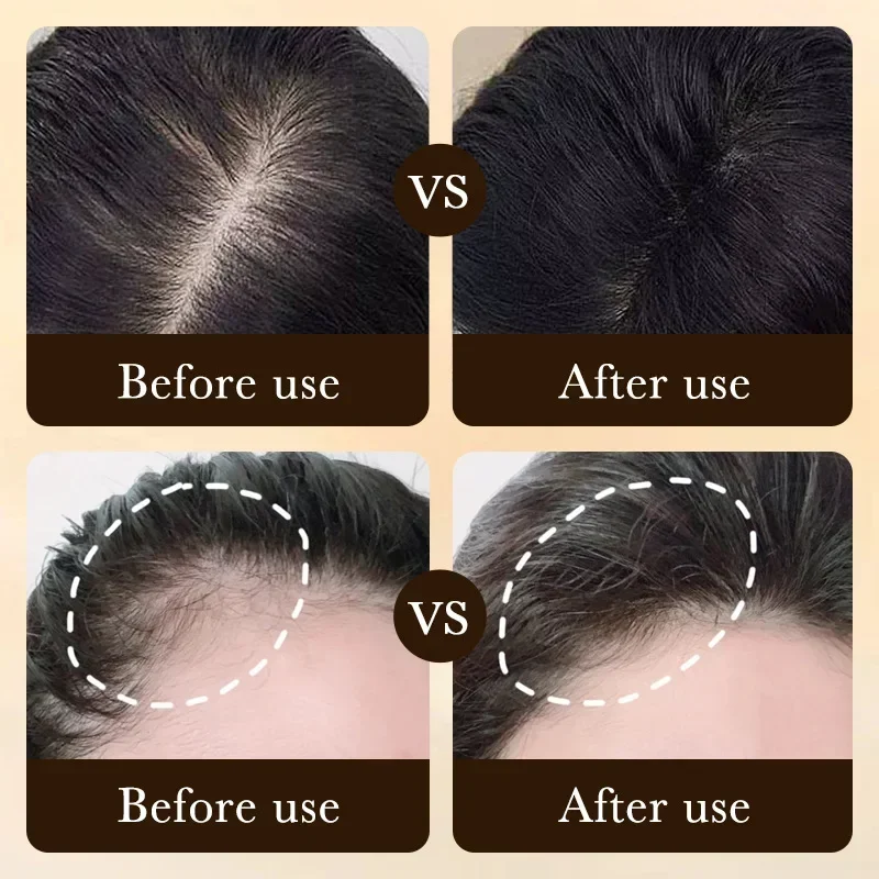 Óleo de Crescimento Rápido de  - Caffeine Hair Serum avaliação e preço