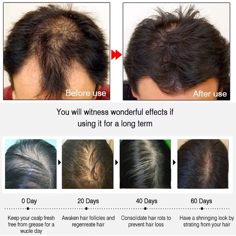 Spray de Crescimento Rápido de - Hair Care Tonic avaliação e preço